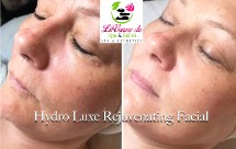 Hydro Luxe Rejuvenating Facial 