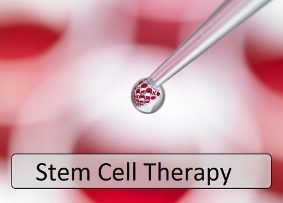 Stem Cell therapy