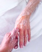 Arm & Hand Rejuvenation Therapy