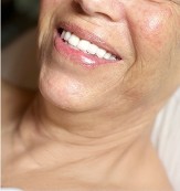 neck only view of after mesenchymal stem cell neck lift 