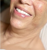  Before Throat Mesenchymal Stem Cell Firming